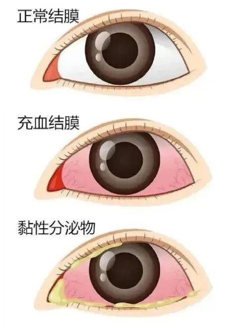 0003