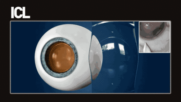 0009.gif