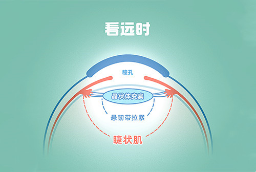 一到冬天孩子近视度数就加深更快？原因是…… 