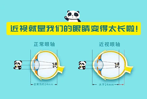 新版眼轴发育对照标准，快看看您家孩子的眼轴长度超标了吗？