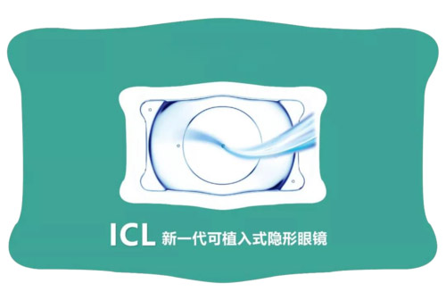 同样近视手术，为什么ICL晶体植入价格稍高? 