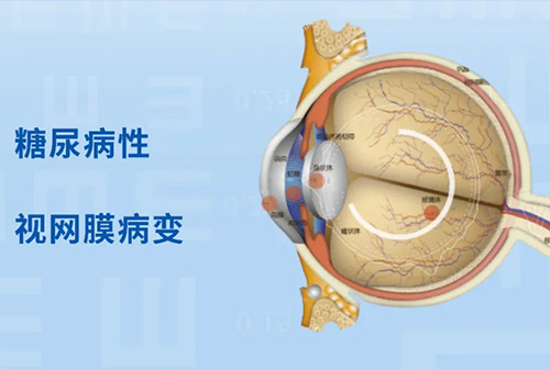 过了腊八就是年，年关将至，要格外警惕这个“视力杀手”！ 