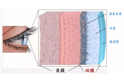 秋风吹眼干！这5种干眼类型，你属于哪种？