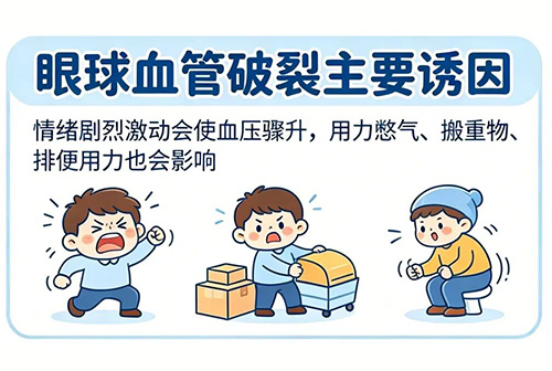 热搜第一！知名女演员眼睛血管被气爆！重要提醒：这些情况务必及时就医