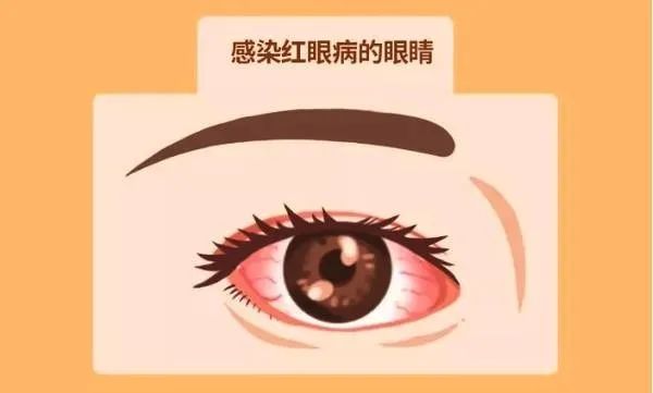 0003