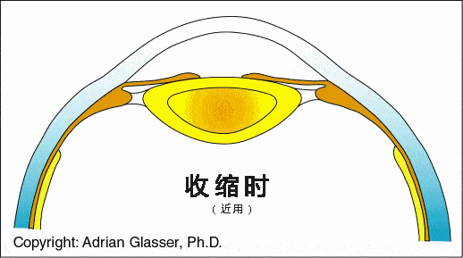 孩子只是配副眼镜，为什么要散瞳？