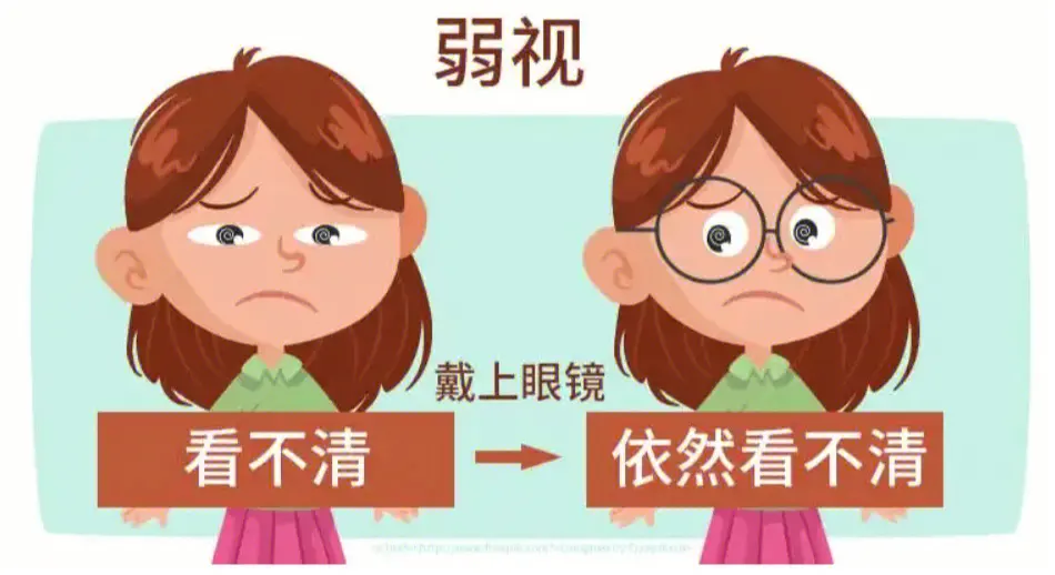 眼睛看不清，不一定是近视，这个病不及时治，可能会影响终生！