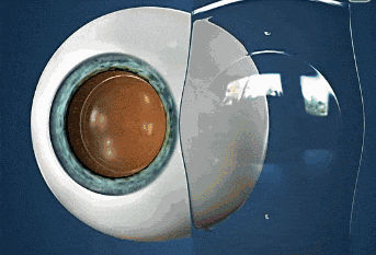 wx_fmt=gif&tp=wxpic&wxfrom=5&wx_lazy=1&wx_co=1