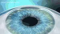 0003