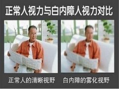 白内障危害多，如何预防？ 